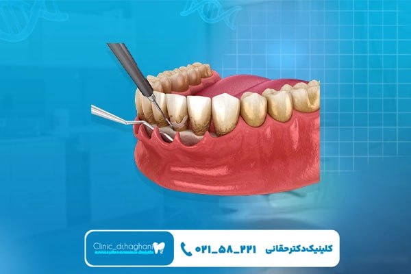 کلینیک دندانپزشکی تهران