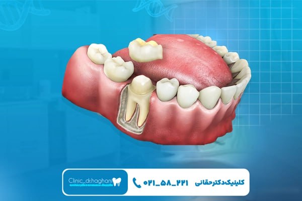 کلینیک دندانپزشکی تهران