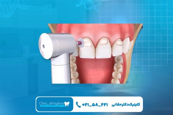 بهترین دندانپزشک بهترین دندانپزشک