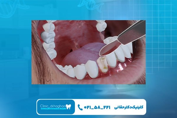 بهترین دندانپزشک بهترین دندانپزشک