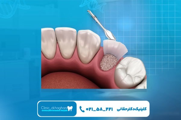 دندانپزشک تهران دندانپزشک تهران