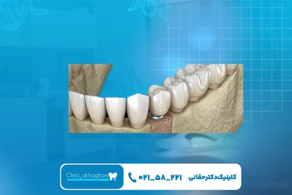 دندانپزشک تهران دندانپزشک تهران