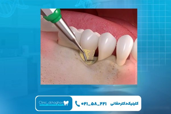 بهترین مرکز دندانپزشکی