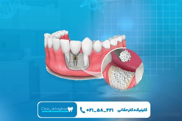 بهترین کلینیک دندانپزشکی