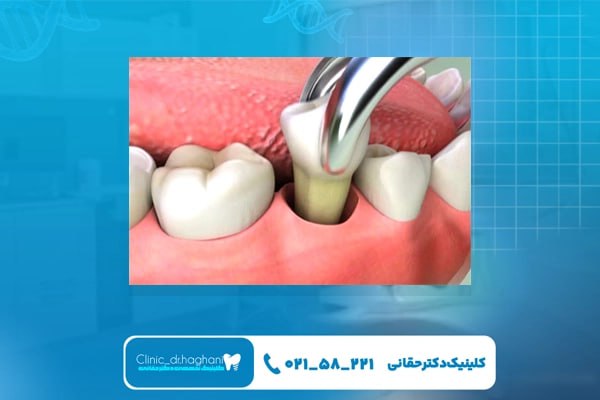 بهترین کلینیک دندانپزشکی