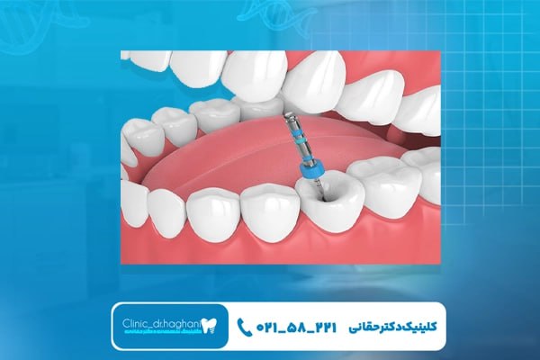 کلینیک دندانپزشکی تخصصی