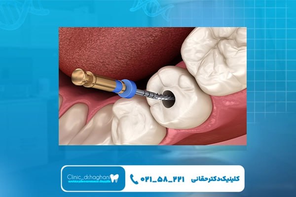 کلینیک دندانپزشکی تخصصی