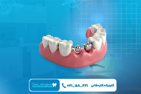 دندانپزشک شمال تهران