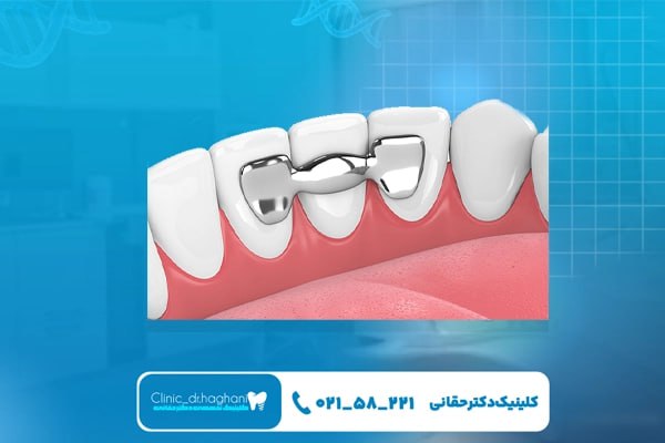 خدمات زیبایی در مرکز دندانپزشکی دکتر حقانی