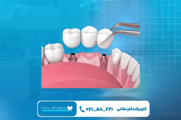 دندانپزشک شمال تهران