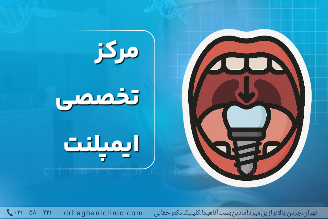 مرکز تخصصی ایمپلنت