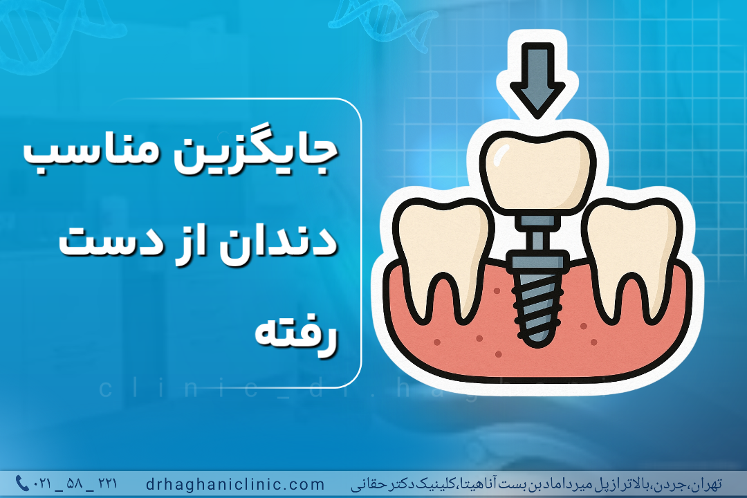 جایگزین مناسب دندان از دست رفته