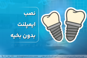 نصب ایمپلنت بدون بخیه