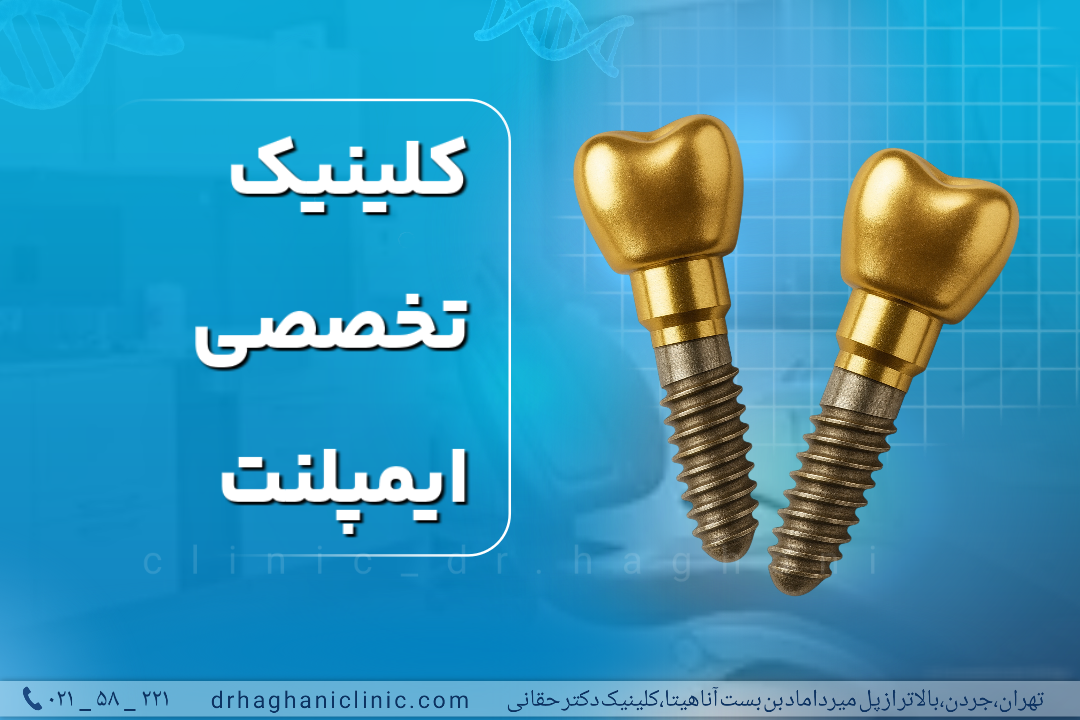 کلینیک تخصصی ایمپلنت