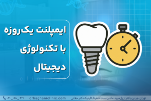 ایمپلنت یک‌روزه با تکنولوژی دیجیتال