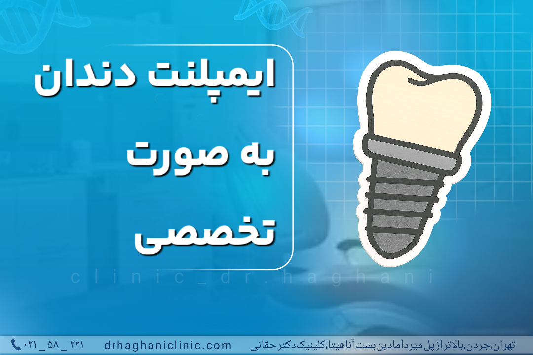 ایمپلنت دندان به صورت تخصصی