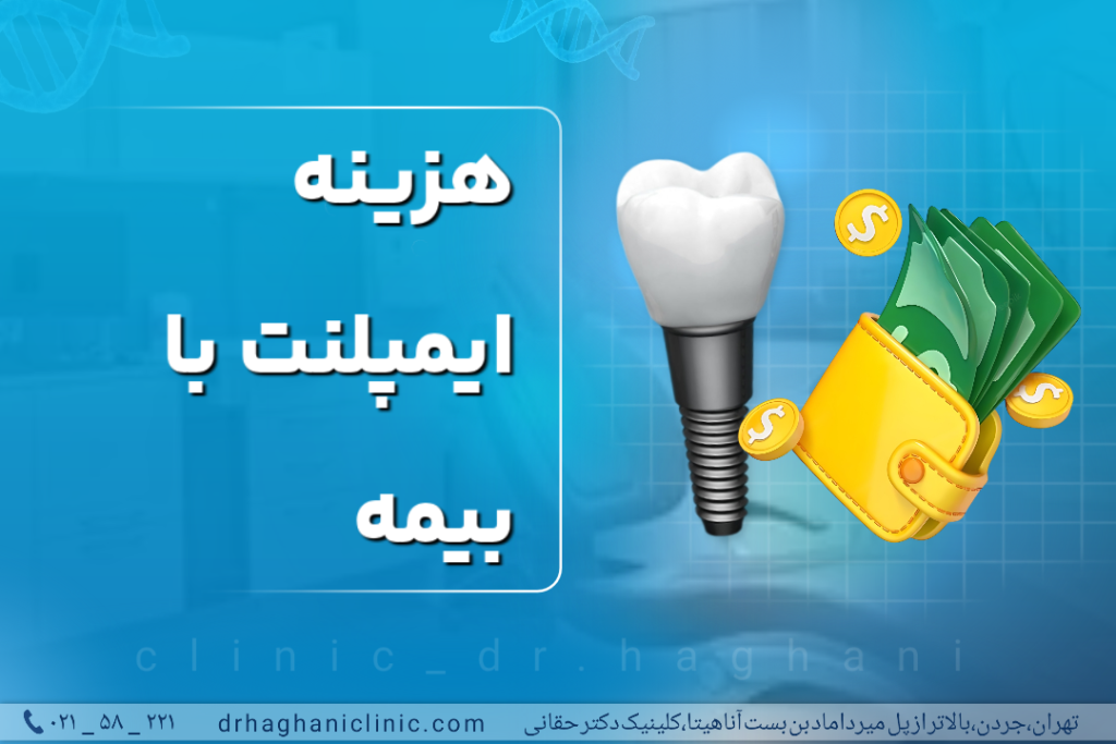 هزینه ایمپلنت با بیمه