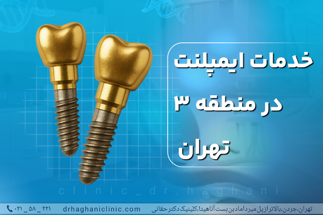 خدمات ایمپلنت در منطقه 3 تهران