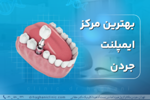 بهترین مرکز ایمپلنت جردن