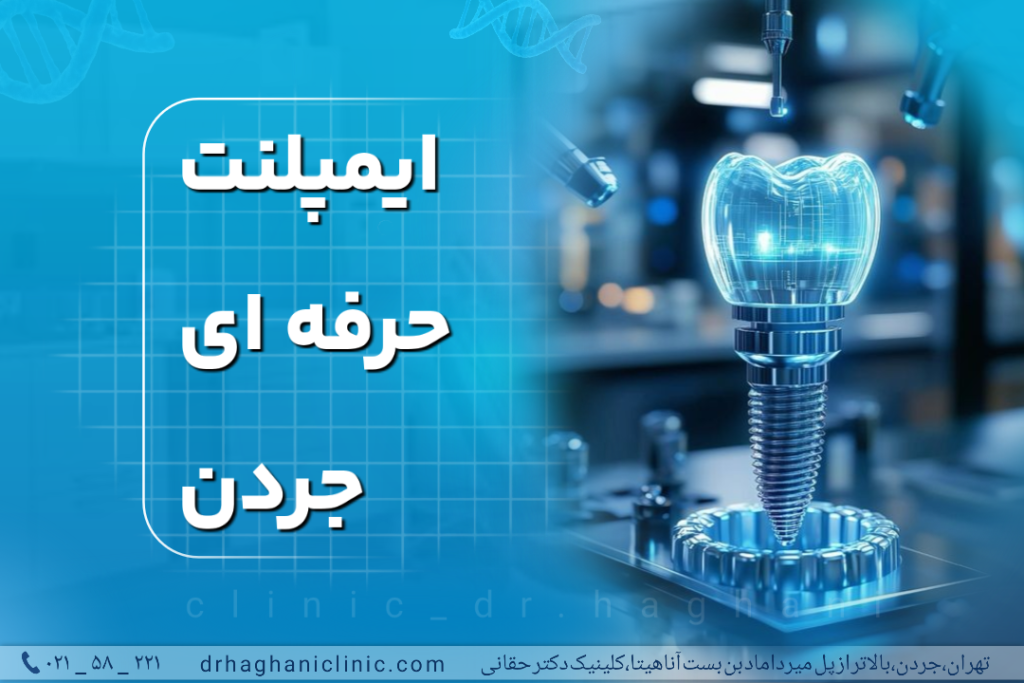 ایمپلنت حرفه‌ای جردن