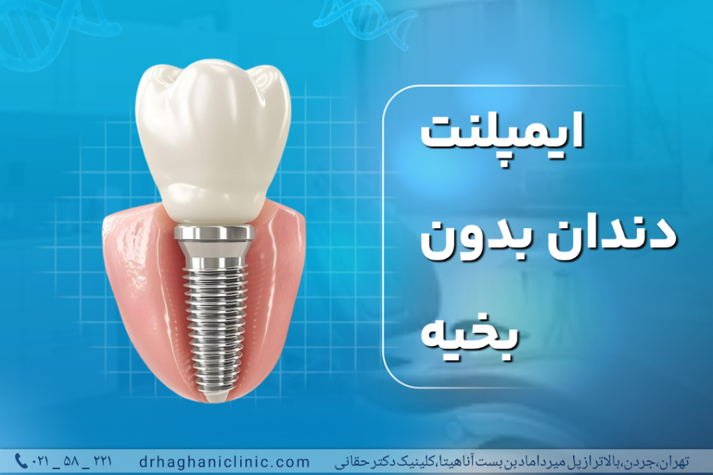 ایمپلنت دندان بدون بخیه