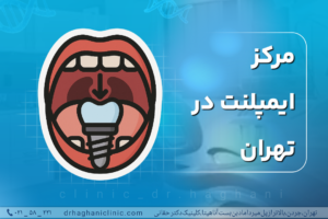مرکز ایمپلنت در تهران