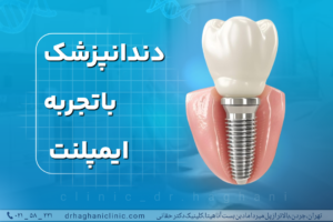 دندانپزشک باتجربه ایمپلنت