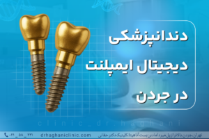 دندانپزشکی دیجیتال ایمپلنت در جردن