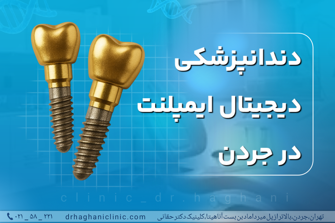 دندانپزشکی دیجیتال ایمپلنت در جردن