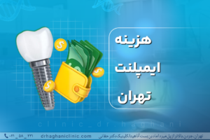 هزینه ایمپلنت تهران