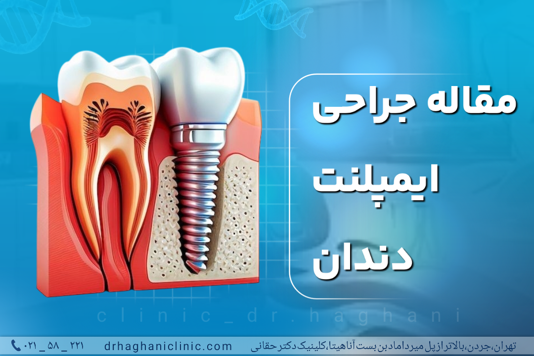 جراح ایمپلنت دندان