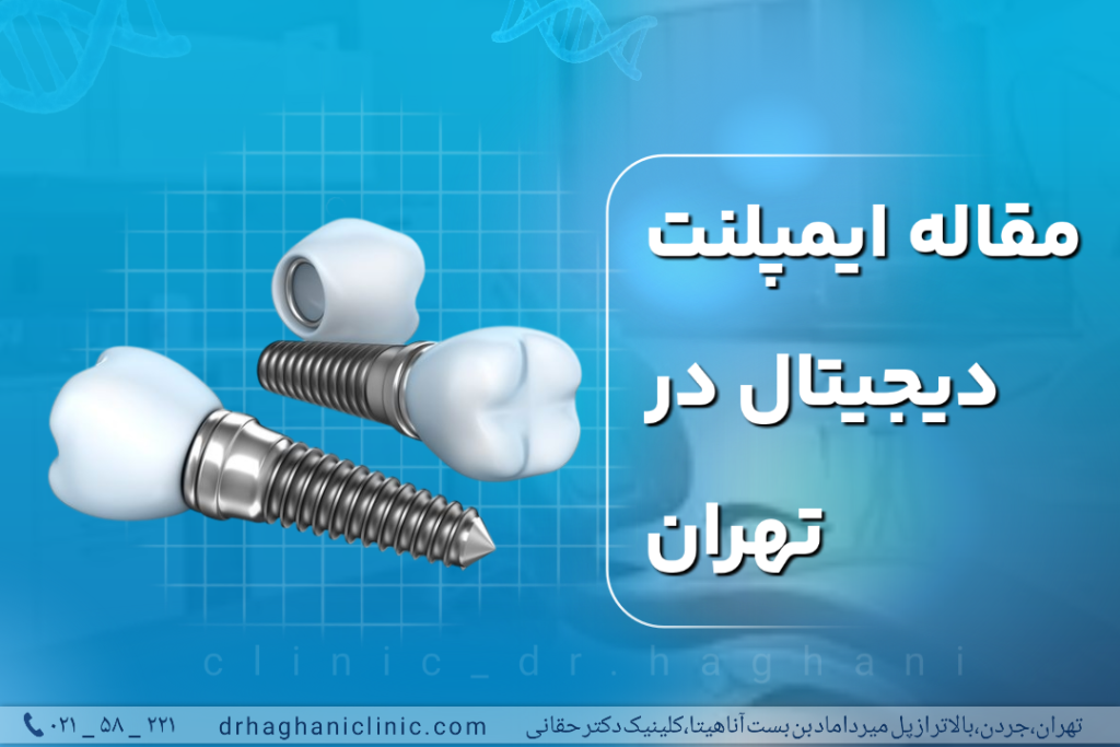 ایمپلنت دیجیتال در تهران
