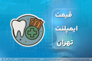 قیمت ایمپلنت دندان