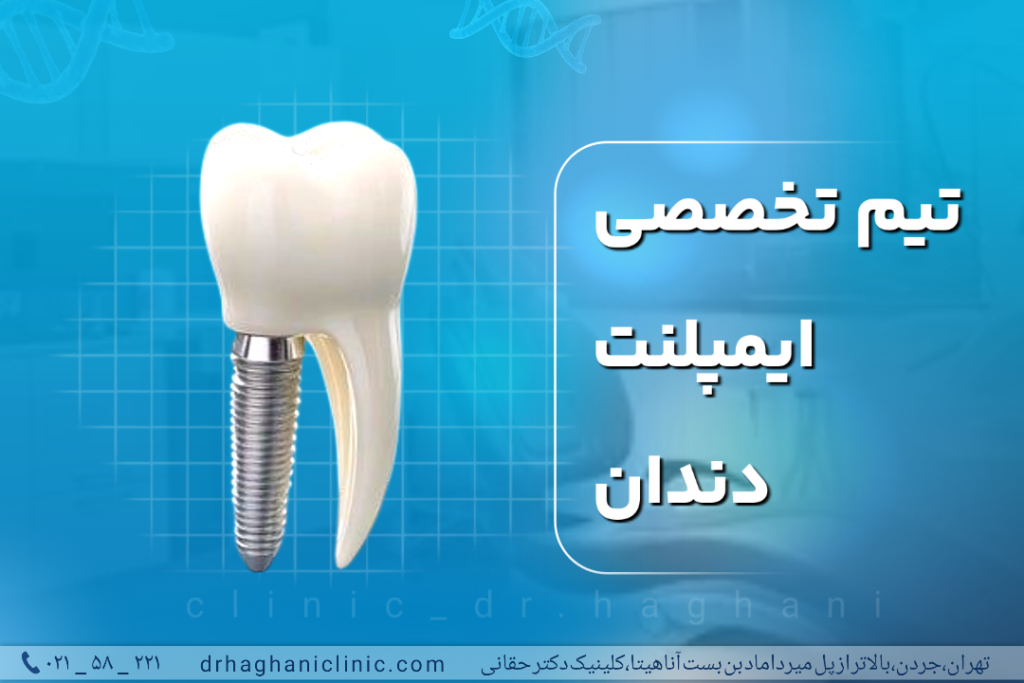 تیم تخصصی ایمپلنت دندان