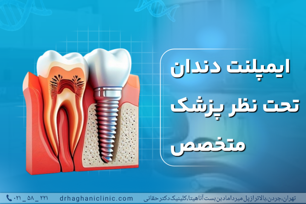 ایمپلنت دندان تحت نظر پزشک متخصص