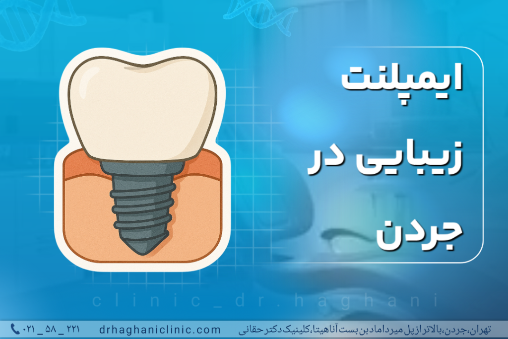 ایمپلنت زیبایی در جردن