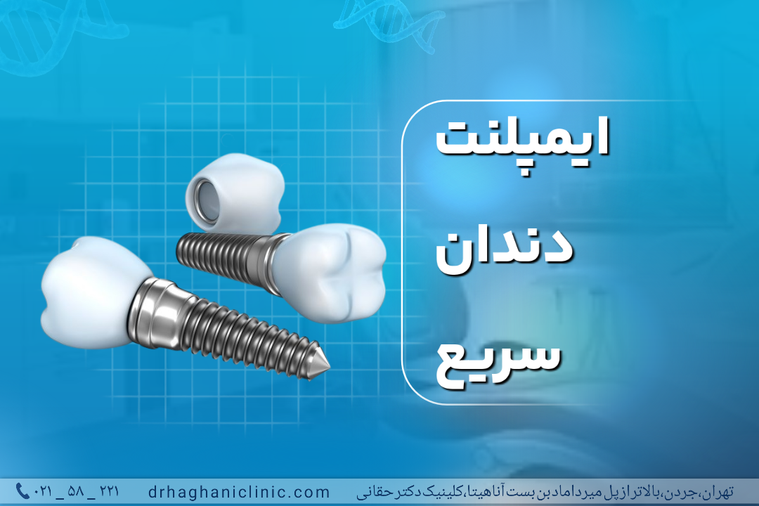 ایمپلنت دندان سریع