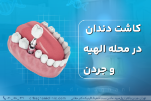 کاشت دندان در محله الهبه و جردن