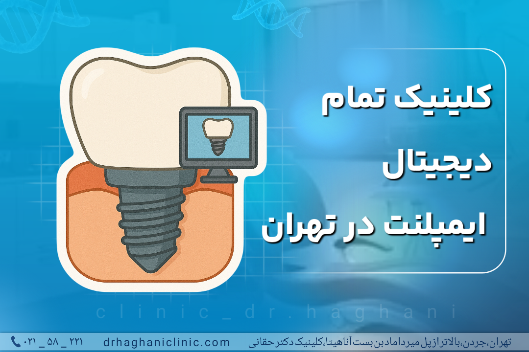 کلینیک تمام دیجیتال ایمپلنت در تهران