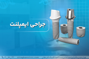 جراحی ایمپلنت