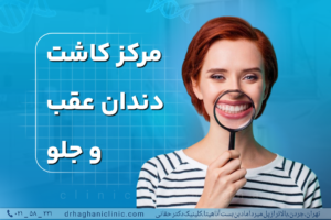 مرکز کاشت دندان عقب و جلو