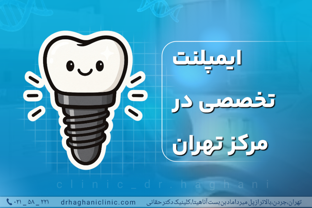 ایمپلنت تخصصی در مرکز تهران