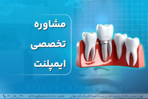 مشاوره تخصصی ایمپلنت