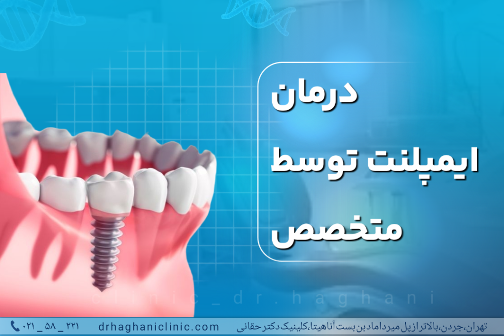 درمان ایمپلنت توسط متخصص