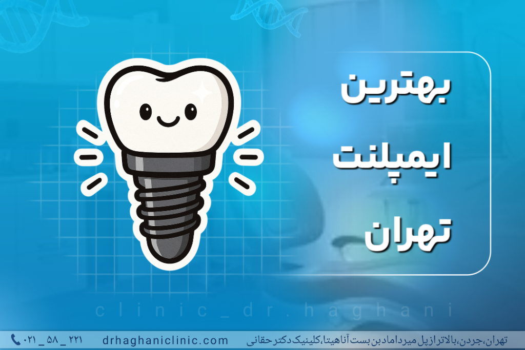 بهترین ایمپلنت تهران