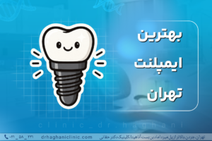بهترین ایمپلنت تهران