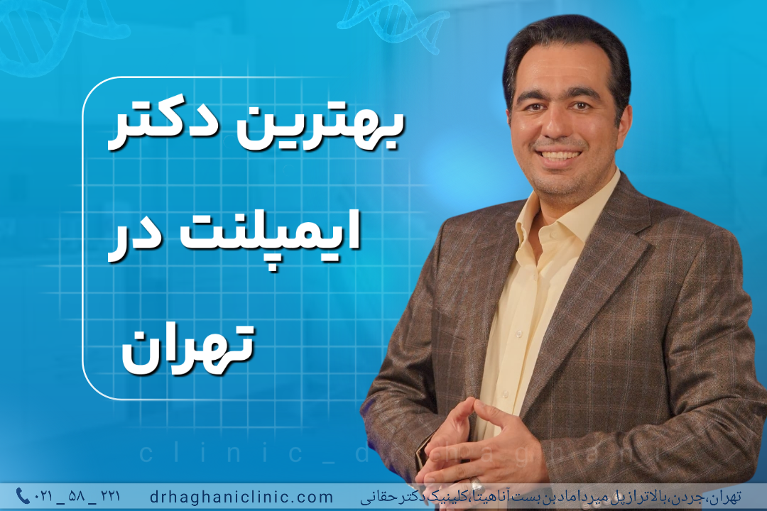 بهترین دکتر ایمپلنت در تهران