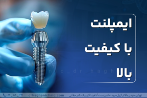 ایمپلنت با کیفیت بالا