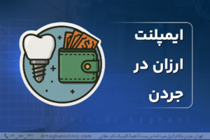 ایمپلنت ارزان در جردن