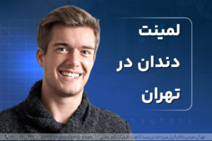 لمینت دندان در تهران
